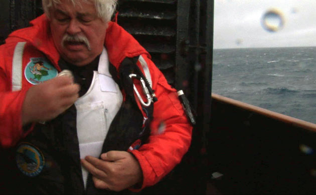 Paul Watson removes bullet