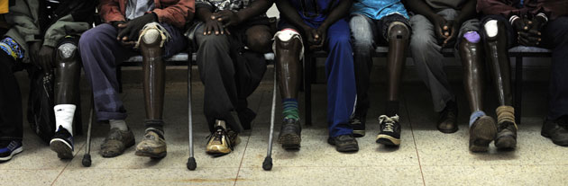 30 April 2009: Huambo, Angola: Landmine victims wait to start physiotherapy