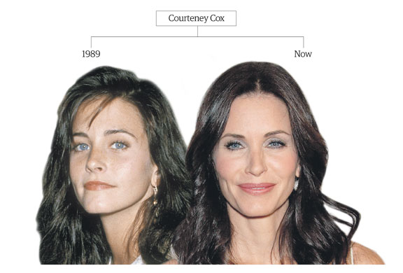 Botox: Courteney Cox