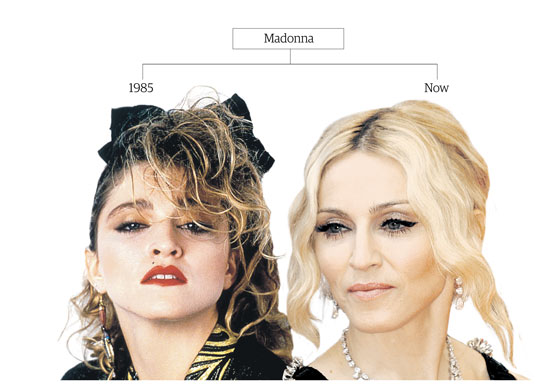 Botox: Madonna