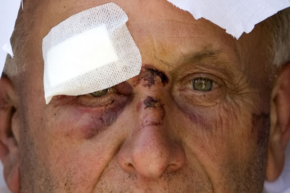 Earthquake aftershock: A survivor sits in an ambulance