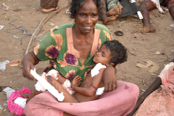 Sri Lanka : handout pic of injured Sri Lnakan tamils