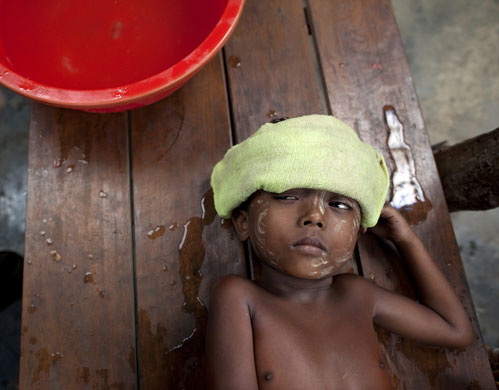 24 hours in pictures: Malaria In Arakan State In Burma