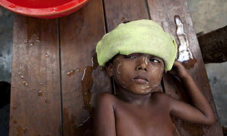 A Rohingya boy suffering from malaria, Burma