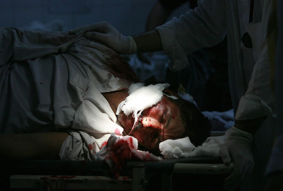 29 May 2009: Peshawar, Pakistan: A doctor comforts a victim of a bomb blast