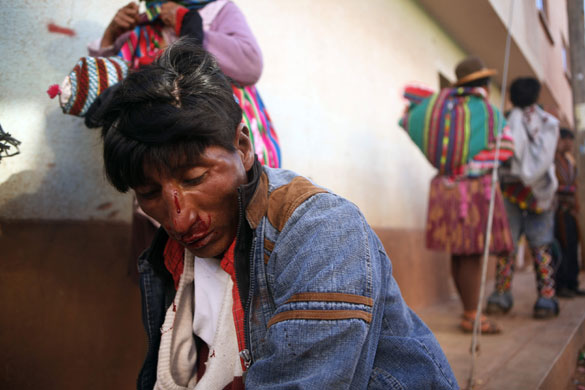 Thinku festival: Blood drips from a man's nose