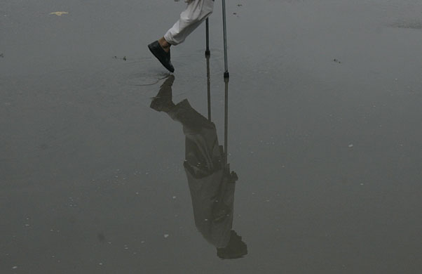 24 hours in pictures: an Afghan man who lost his leg in an explosion