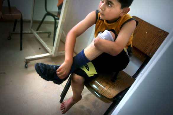 24 hours: Center for artificial limbs