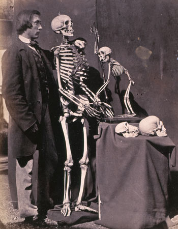 Endless Forms: Reginald Southey with Skeletons and Skulls