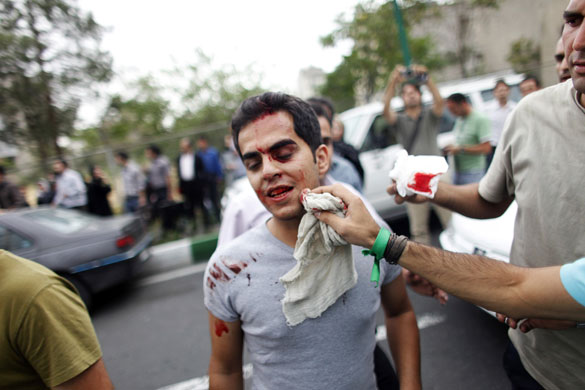 24 hours: An injured supporter of Iran's moderate presidential candidate