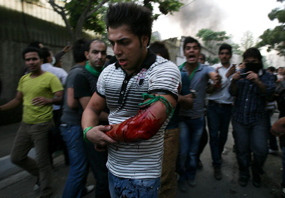 Iran protests: Iranians react as a protestor is wounded after gunmen opened fire