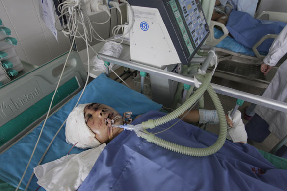 Urumqi riots: A victim of the riots in the hospital