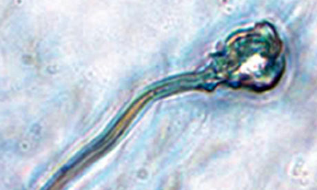 animal cell through microscope. A microscope image of IVD