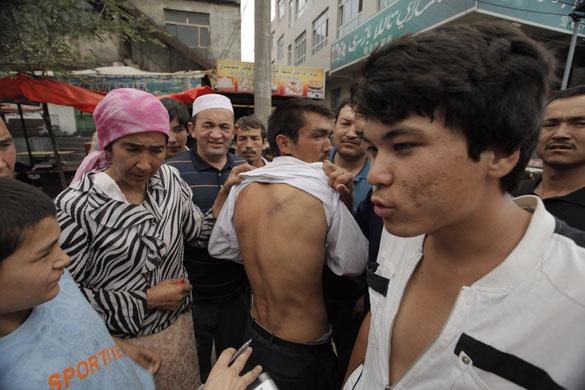 Urumqi: Uighurs show off what they claim to be wounds from fighting on the streets