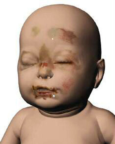 baby p: Injuries to Baby P