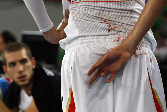 24sport: Robin Benzing of Germany wipes the blood from a cut