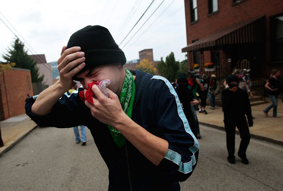 Injured demonstrator {Guardian.co.uk}