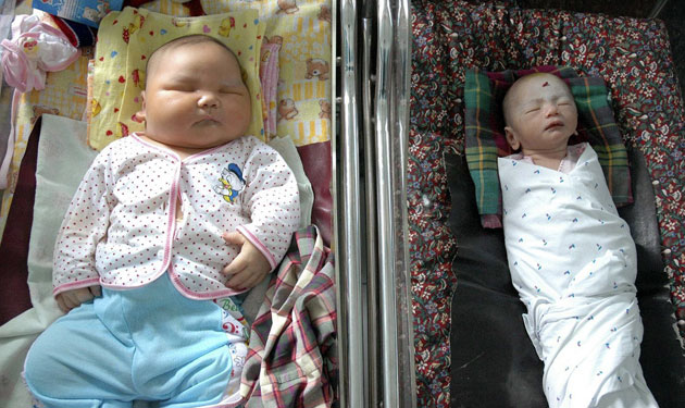 25 September 2009: Kisaran, Sumatra: A three-day old baby weighing 8.7 kg
