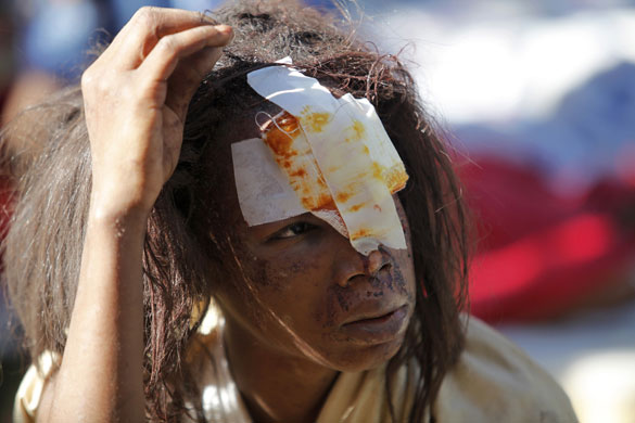 haiti update 3: An injured resident waits for medical earthquake in Port-au-Prince
