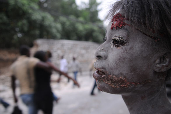 haiti update 3: An injured person is seen after an earthquake hit Port-au-Prince, Haiti