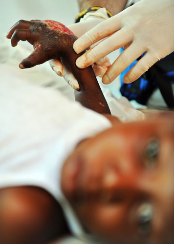 24 Hours in Pictures: Haiti injured