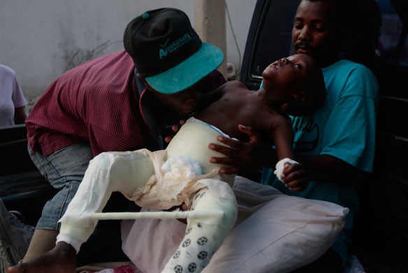 Haiti: Injured chils at hospital in haiti