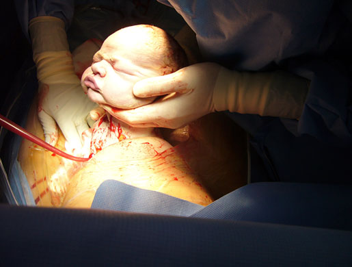 new tailoring: baby being delivered