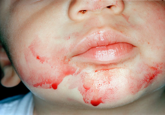 Sean O'Hagan on Photo: Elinor Carucci, Cherries 