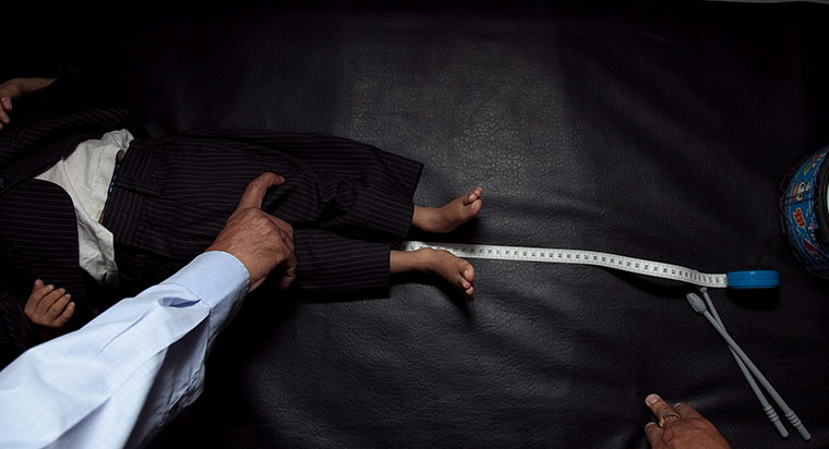 Khagendra Thapa Magar: Pediatrician Hom Kumar Neupane checks height of Khagendra Thapa Magar