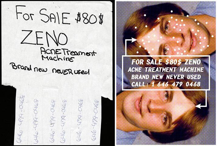 Cardon Copy: Cardon Copy, acne treatment flier