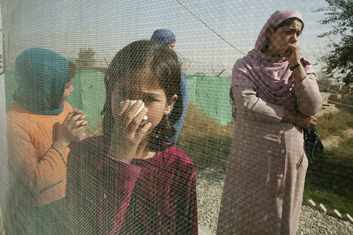 24 hours in pictures: Leishmaniasis sufferers in Kabul, Afghanistan