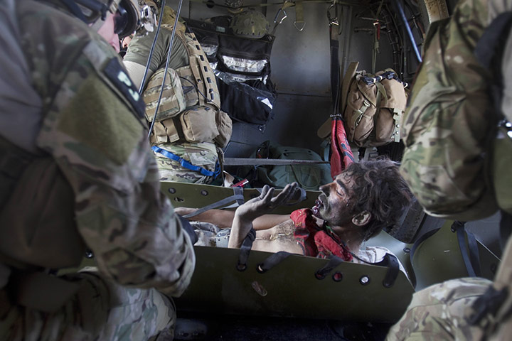 24 hours in pictures: An Afghan soldier looks down to see his leg