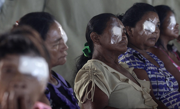 From the agencies: Indigenous women receiving eye surgery in Santa Isabel do Rio Negro
