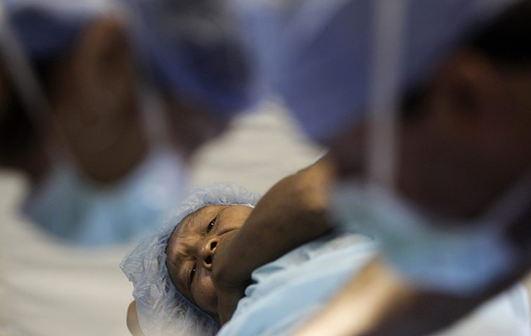 From the agencies: A man from a Yanomami tribe is operated on in Santa Isabel do Rio Negro