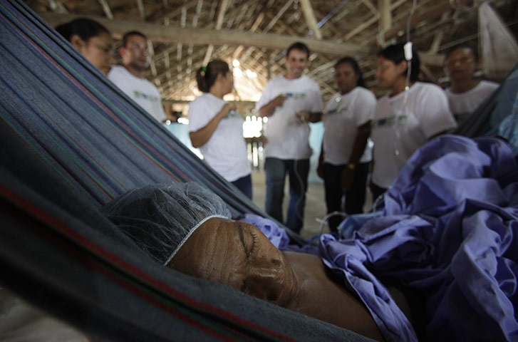 From the agencies: Man rests after doctors removed a cancer tumor in Santa Isabel do Rio Negro