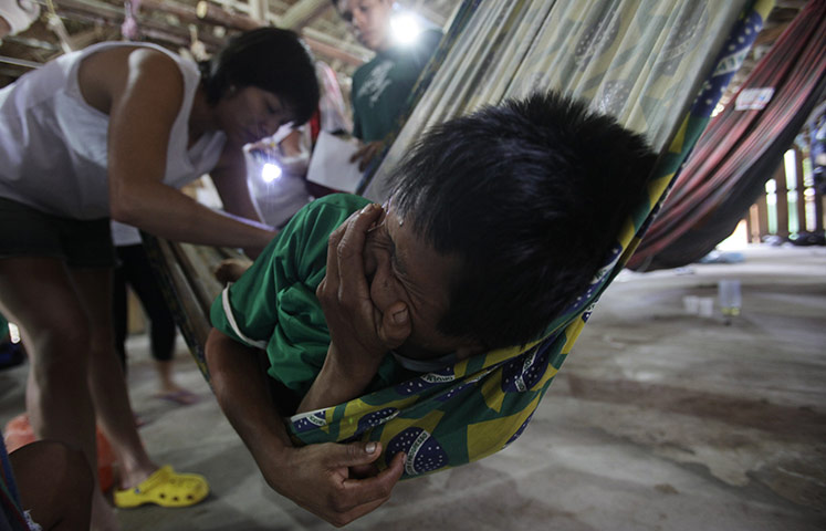 From the agencies: A doctor performs surgery on a man in Santa Isabel do Rio Negro