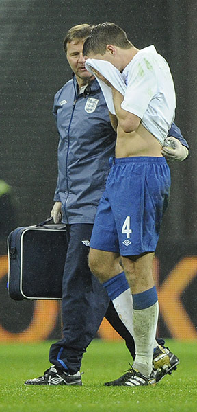 England v France: Steven Gerrard goes off injured after injuring his hamstring