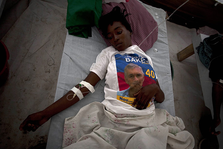 Haiti Cholera: A woman with symptoms of cholera