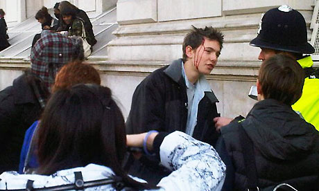 A student protester bleeds from the head during demonstrations in central London