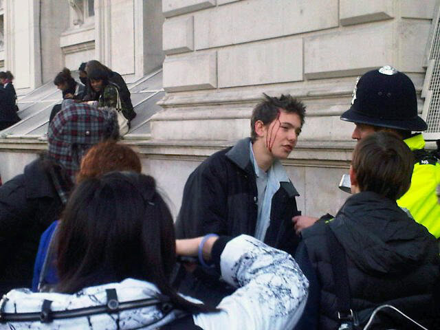 Pictures by students: An injured protester in London