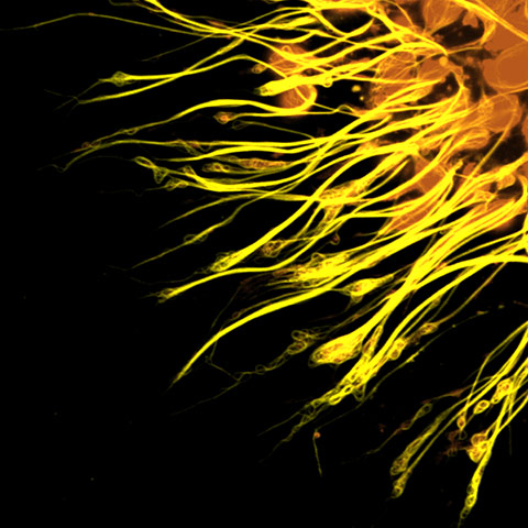 Portraits of the mind: Photomicrograph of the molecular scaffolding of axons