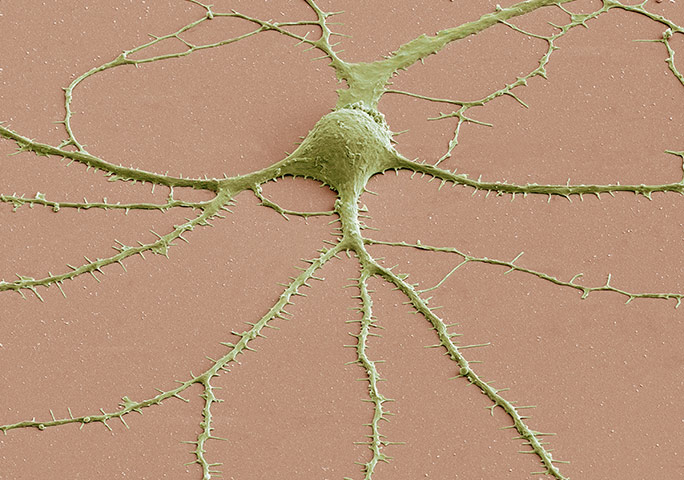 Portraits of the mind: Photomicrograph of a neuron’s cell body