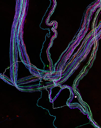 Portraits of the mind: Image taken from a transgenic “Brainbow” mouse