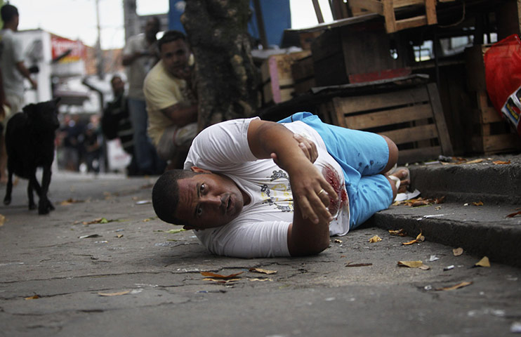 24 hours in pictures: A man injured by a bullet reacts