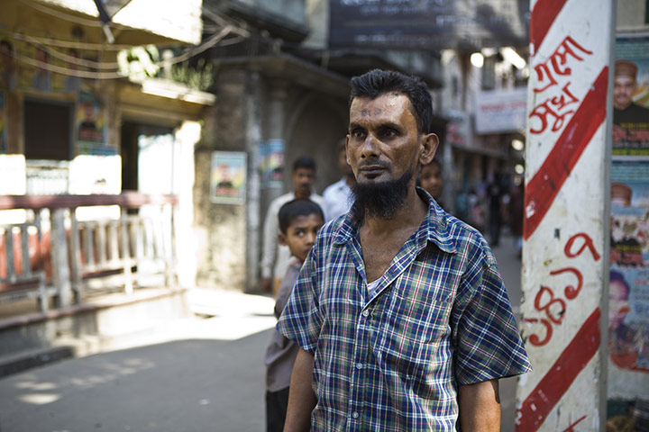 AIDS in Bangladesh: MDG: World Aids Day 2010