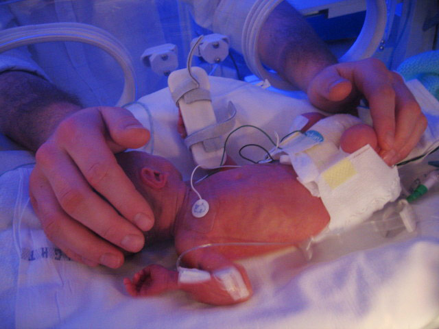 In pictures: touch: premature baby and father