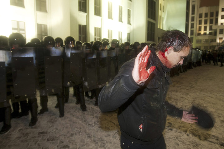 Belarus election violence: A bleeding opposition supporter walks in front of riot police