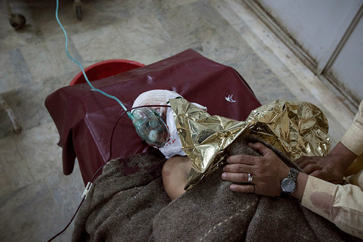 24 hours in pictures: Injured victim of suicide bomb attack in Lady Reading Hospital, Peshawar