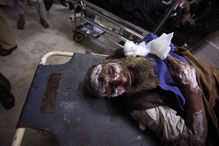 24 hours: Suicide bomb victim in Peshawar