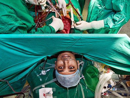 Eyewitness: Awake Cardiac Surgery, Bangalore Fortis Hospital, Bangalore, India
